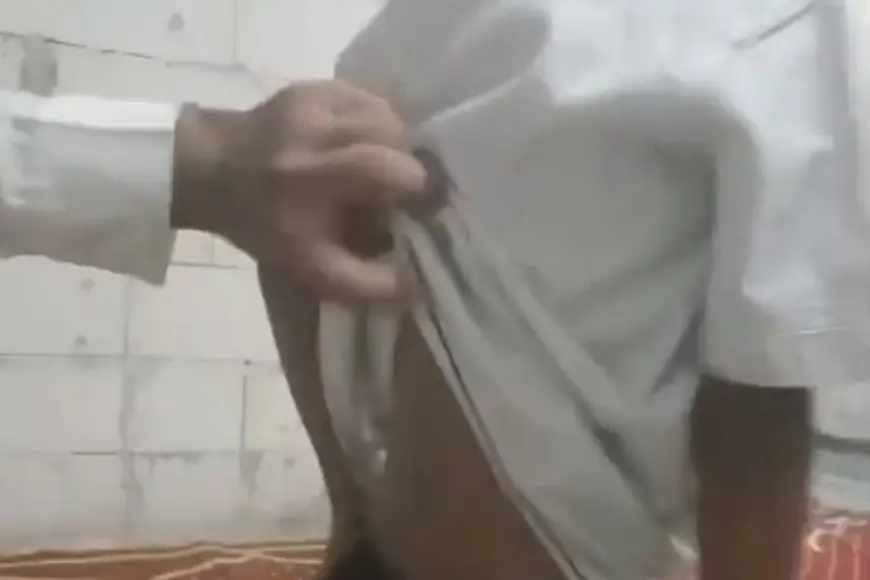 Derita Sakit Kronis dan Gizi Buruk, Bocah di Jombang Butuh Penanganan Medis