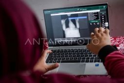 Dinkes Kota Madiun tingkatkan deteksi kasus baru penyakit TBC
