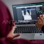 Pemkot Madiun targetkan temuan 1.312 kasus TB hingga akhir 2026